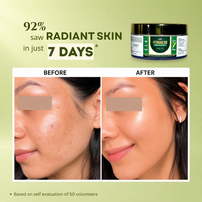 Aegte Hydraglow Skin Renewal Magic Gel | Deep Pore Cleansing & Exfoliation | Dead Skin Removal 50gm